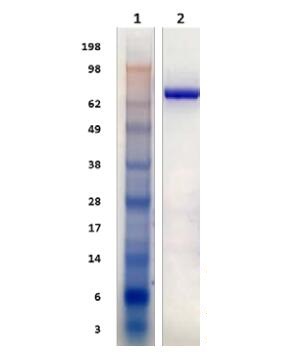 Lane 1: Molecular weight marker (SeeBlue Plus2)<br />Lane 2: CeTRXR